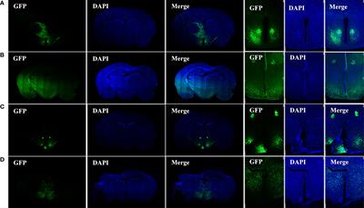 Metabolic Consequences of Neuronal HIF1α-Deficiency in Mediobasal Hypothalamus in Mice